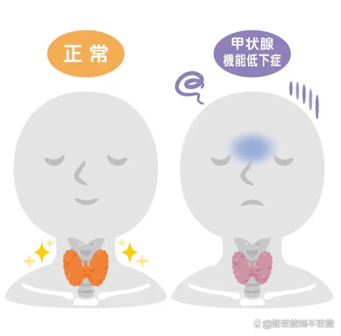 这种“累”别硬扛!医生最新提醒:身体在求救?不是懒!