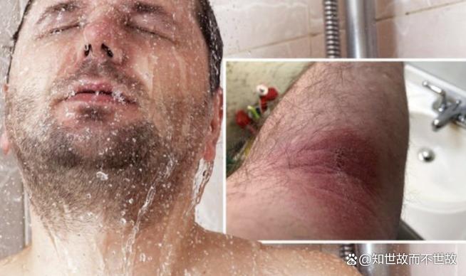 酒店热水夺命:57度水温下的致命13分钟