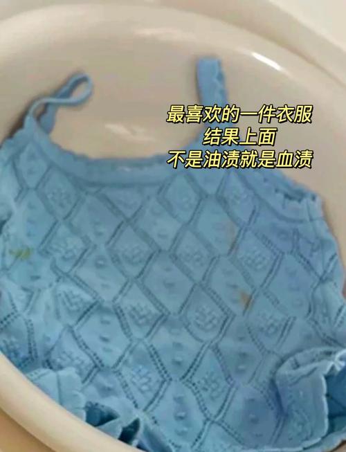 蓝色衣领发黄怎么洗白小妙招?蓝色衣服领子发黄怎么去掉