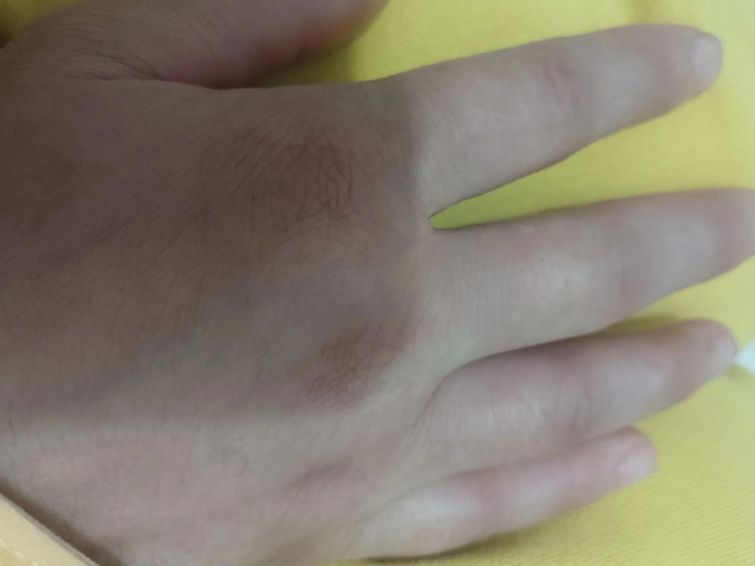 为什么哭时手会变硬？为什么哭完手会肿