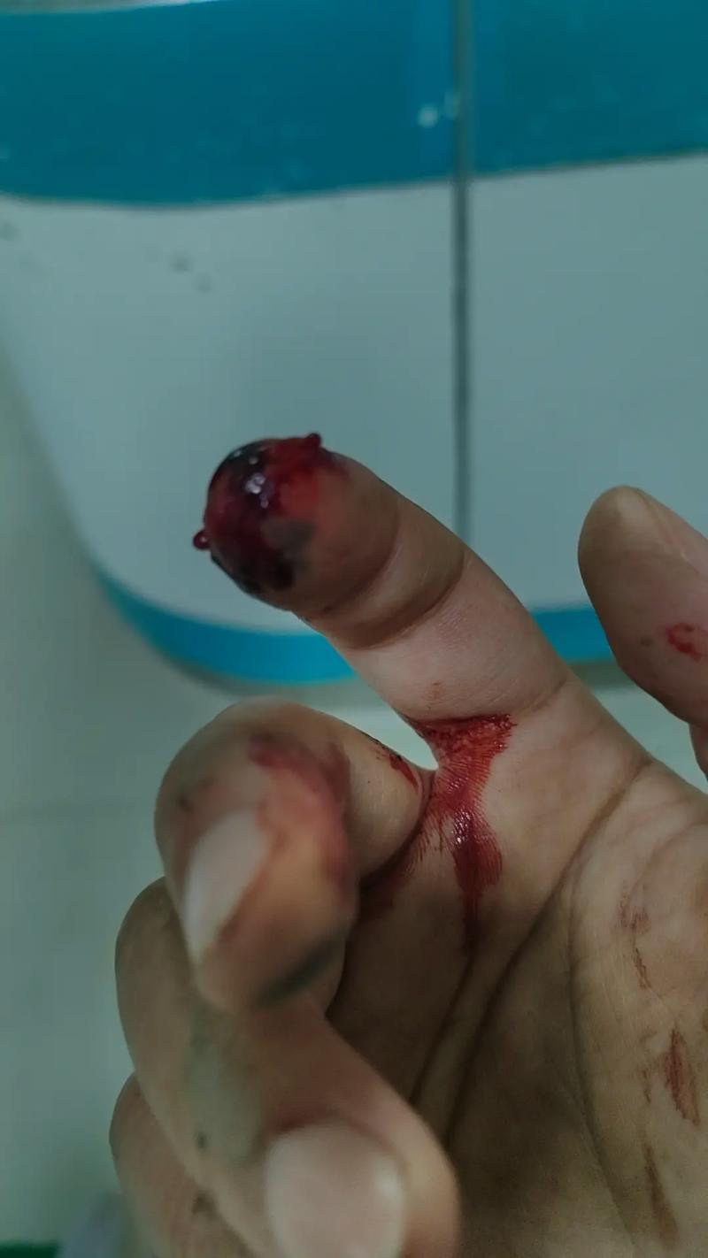 怎么p一个受伤图?怎么ps受伤图