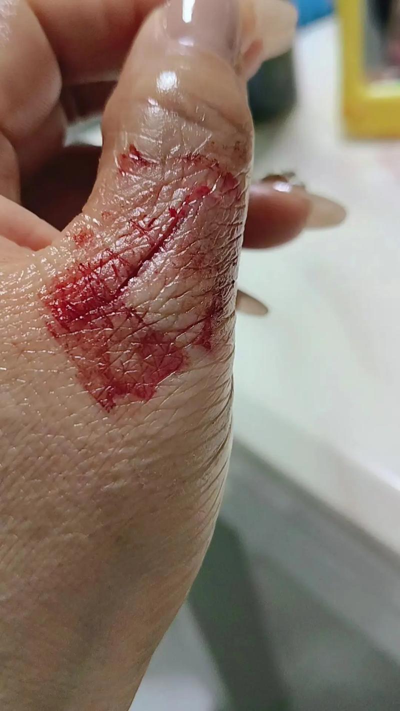 怎么p一个受伤图?怎么ps受伤图