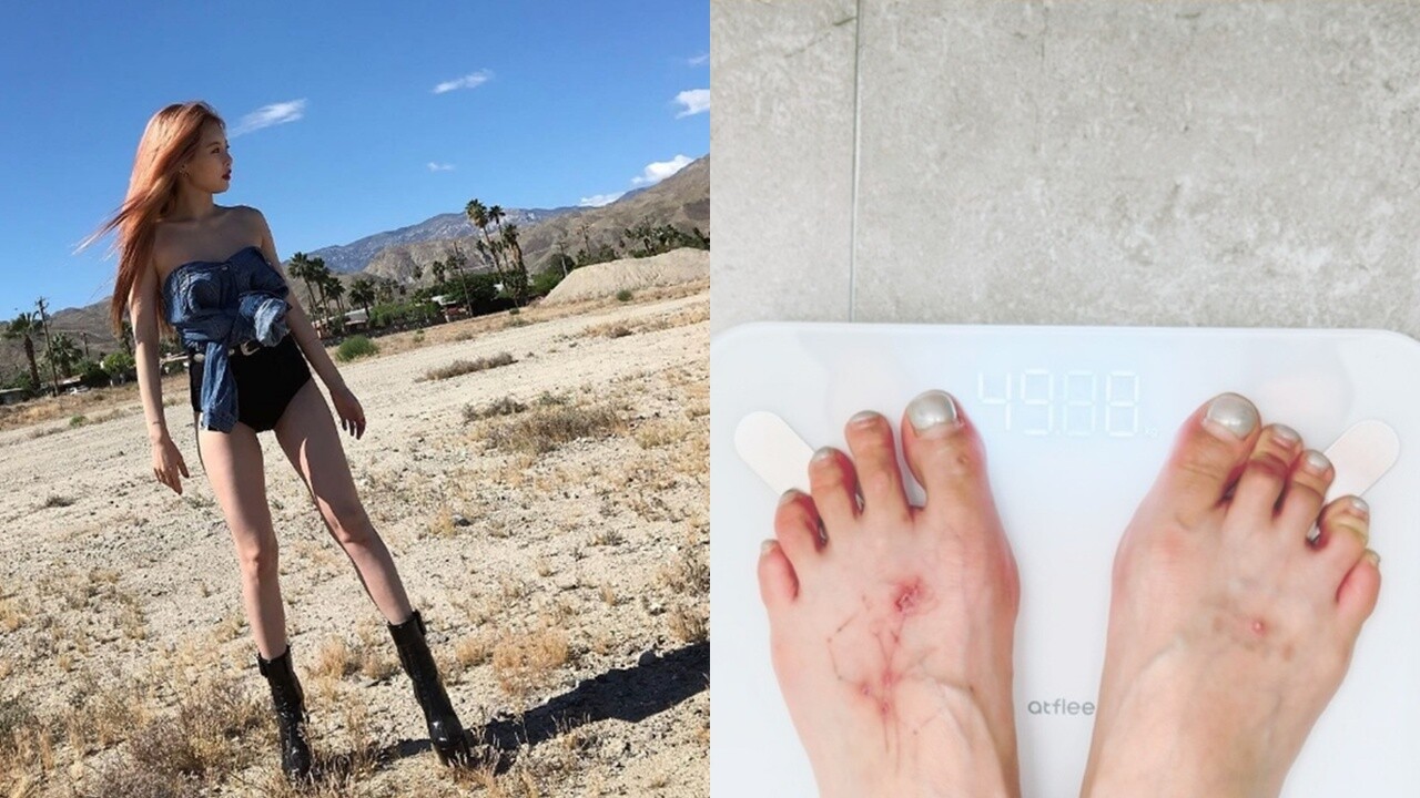 泫雅减肥成功?从「50尾端」到「4」开头,发文认证:「真的很辛苦!」脚伤引发讨论