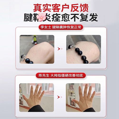 筋包怎么快速消除?起了筋包怎么快速消除