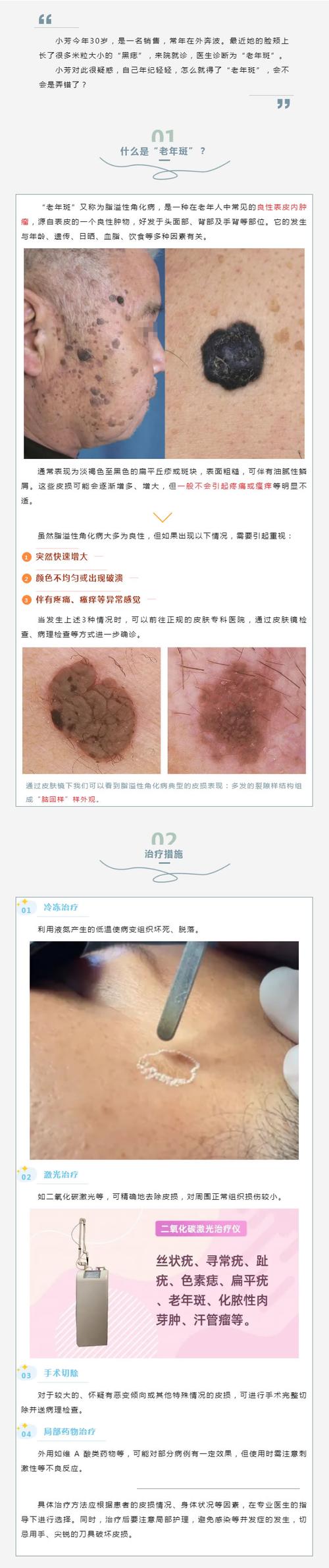 屏幕出现暗斑怎么办?屏幕出现暗斑怎么办恢复