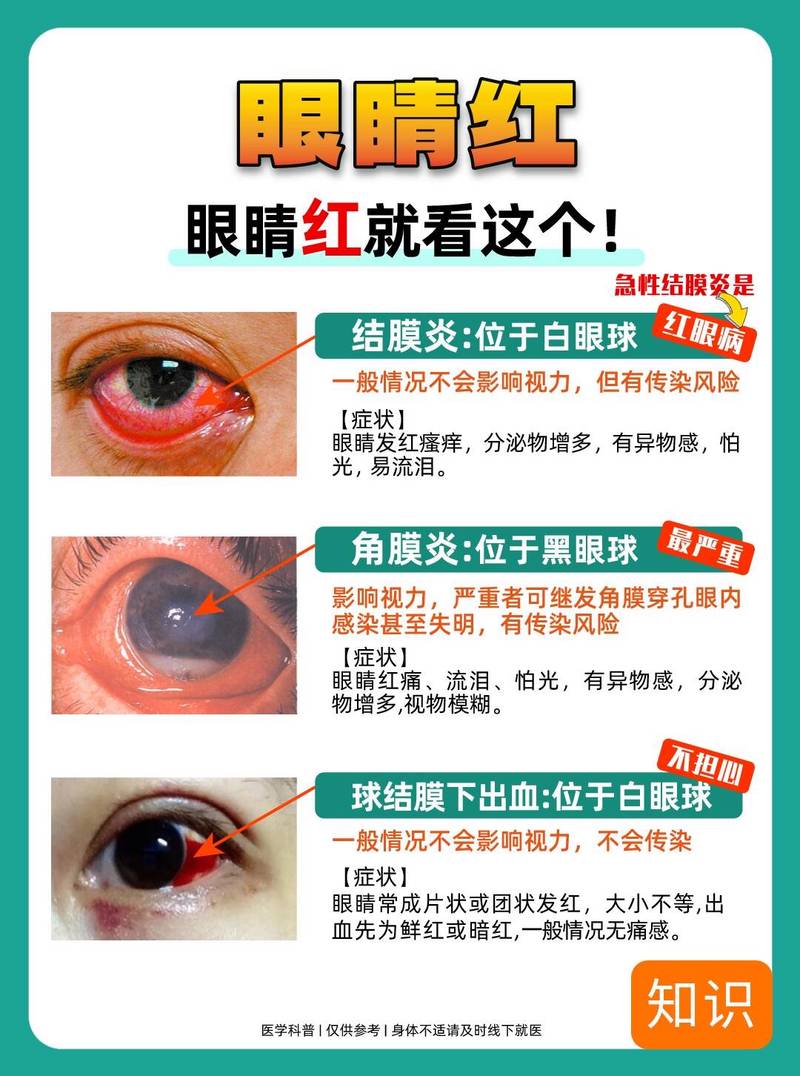 喝酒眼睛红是什么原因造成的?喝酒眼睛红是什么原因造成的呢