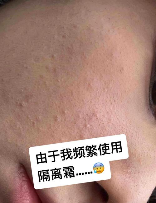 化妆可以不用隔离霜吗女生?化妆可以不用隔离吗对皮肤有危害吗