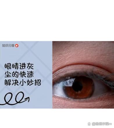 石灰进了眼睛里大概多久能好？石灰进入眼睛处理方法