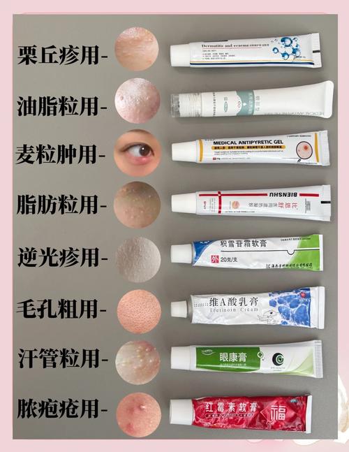 能够燃烧脂肪的药物？有没有燃烧脂肪的药膏