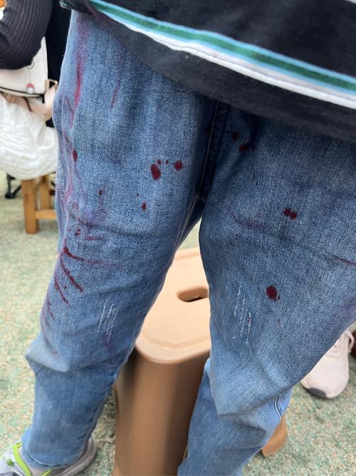 裤子被笔划了一道怎么办小妙招？裤子不小心被笔画了一笔