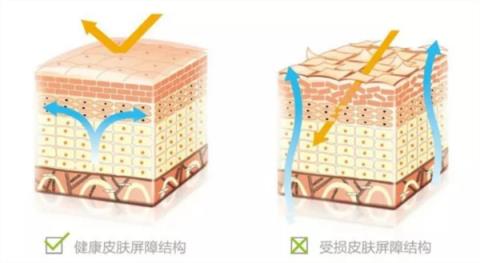 2元一块的硫磺皂 是皮肤病“神器”还是毁肤“杀手”(图2)