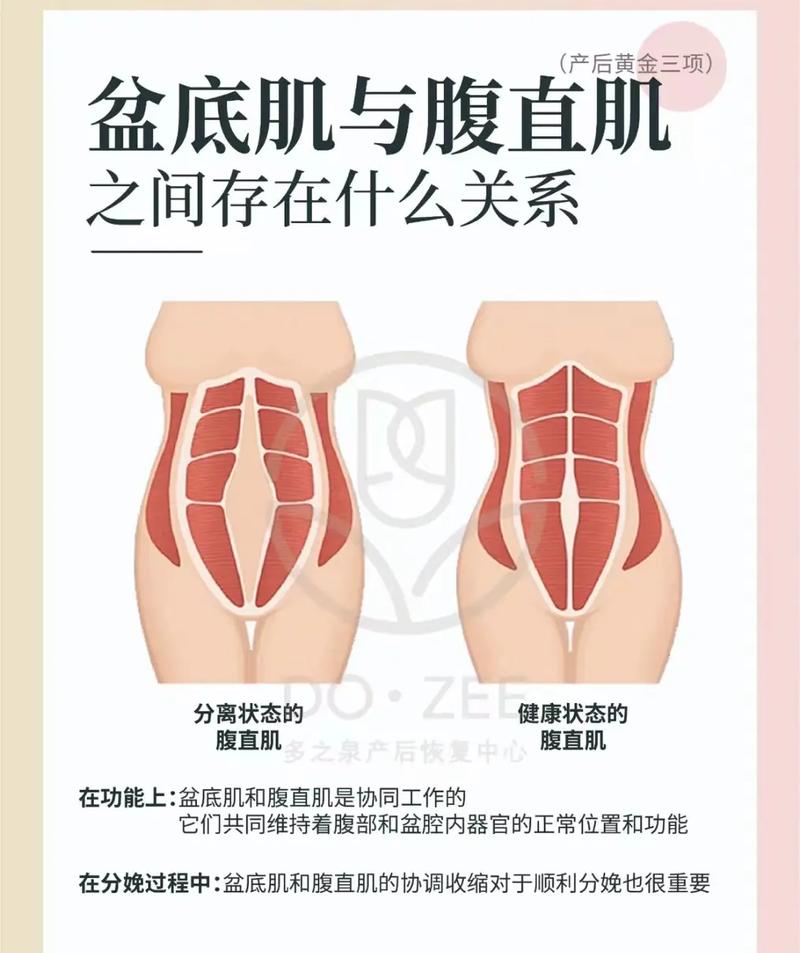 盆底肌和腹直肌可以一起练吗？盆底肌和腹直肌有关联吗