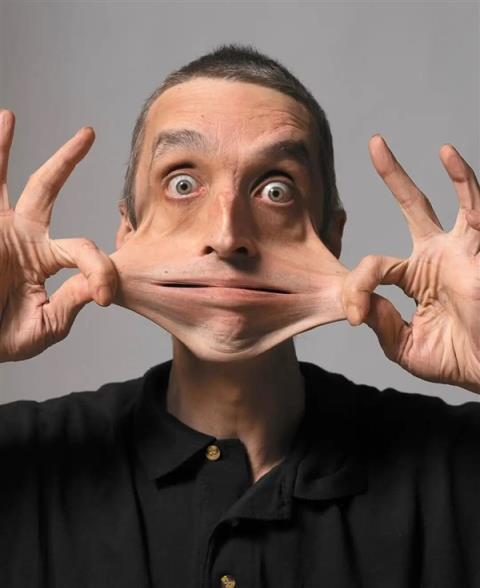 世界上皮肤最有“弹性”的男子 看完可能整个人都不好了(图3)
