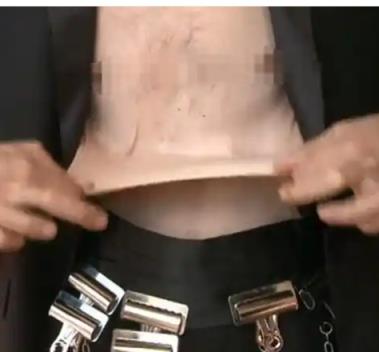 世界上皮肤最有“弹性”的男子 看完可能整个人都不好了(图4)