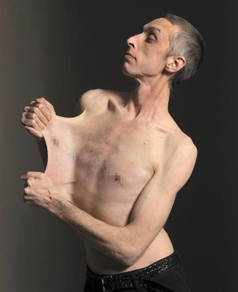 世界上皮肤最有“弹性”的男子 看完可能整个人都不好了(图5)