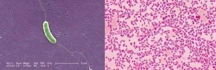 男子处理海鲜被扎伤 几天后突然去世!这些雷区你得知道(图3)