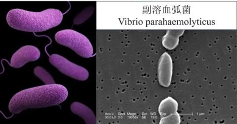 男子处理海鲜被扎伤 几天后突然去世!这些雷区你得知道(图5)