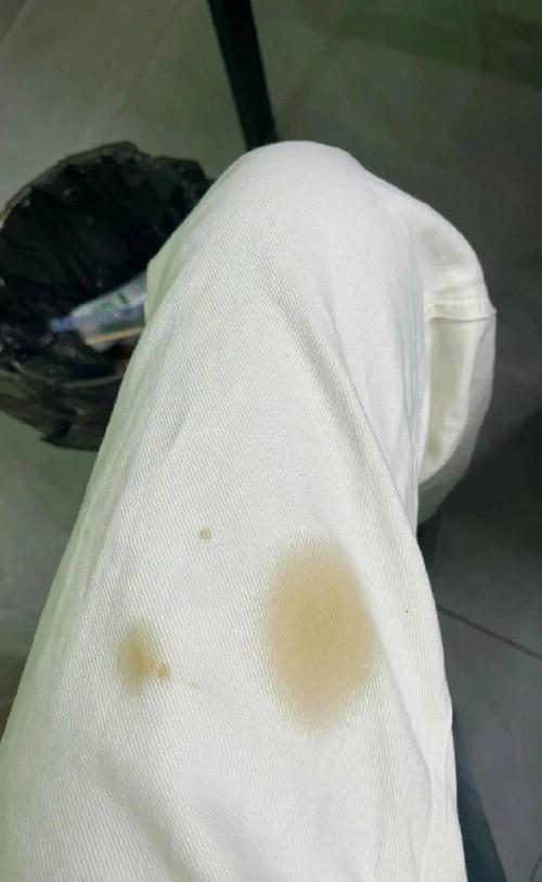 裤子上滴油了怎么办怎么处理?裤子上滴了油怎么去除