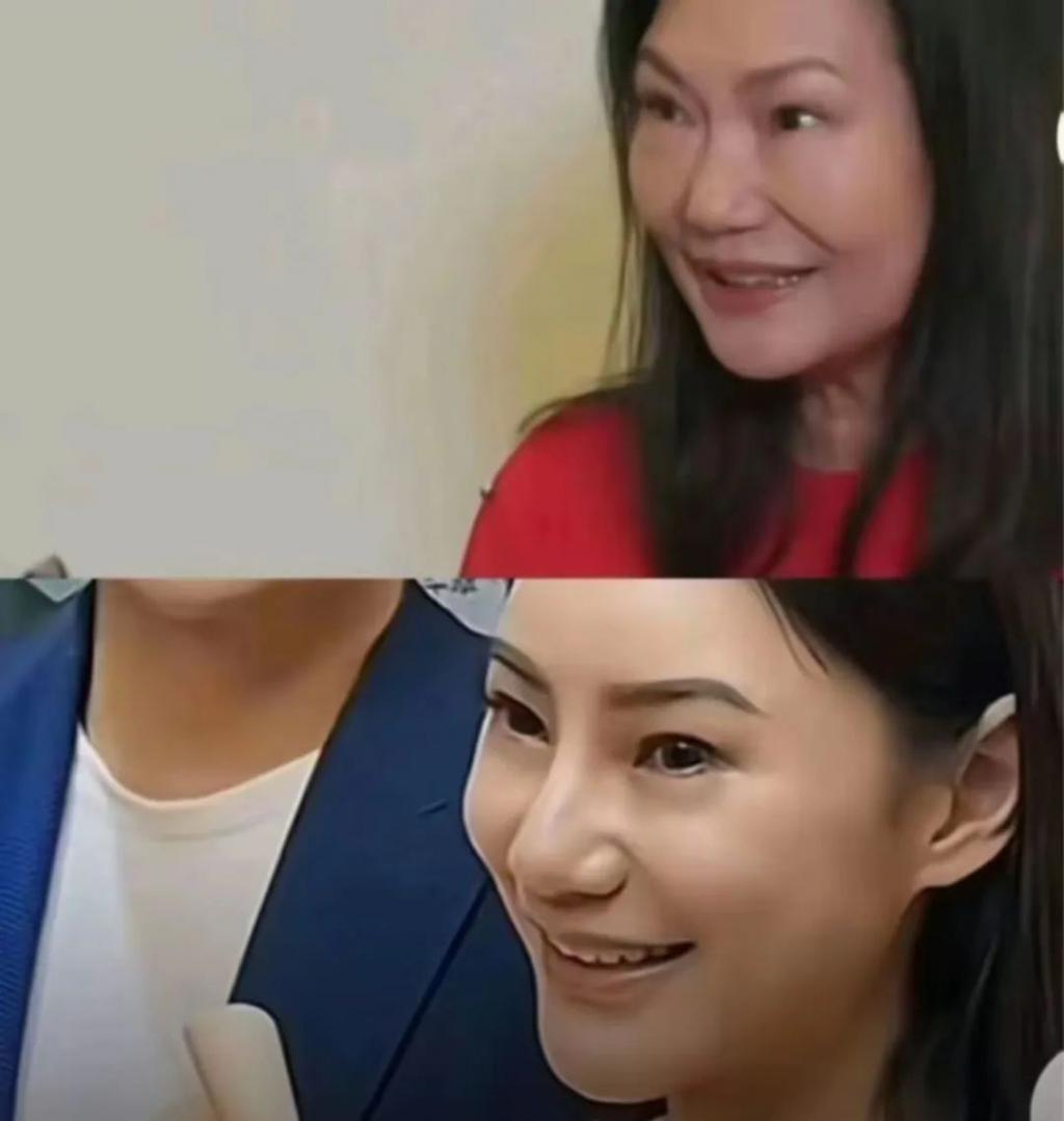 汪小菲婚了,张兰“白癜风”了