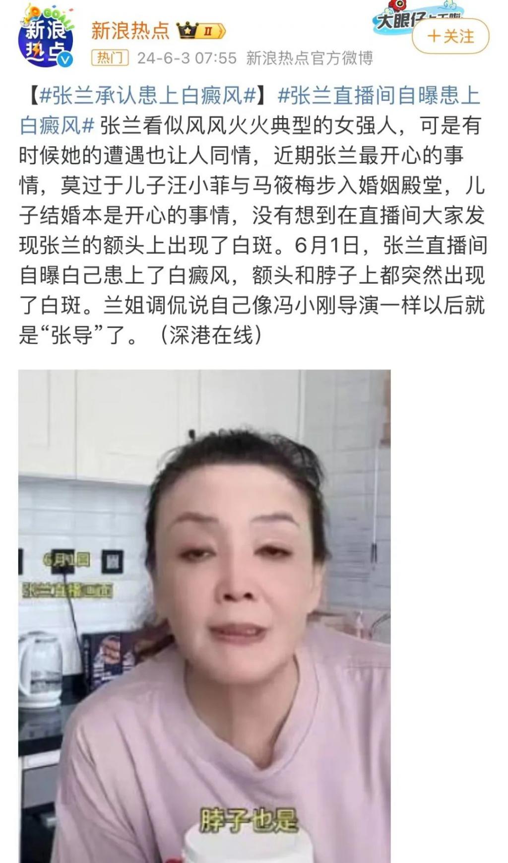 汪小菲婚了,张兰“白癜风”了