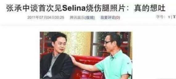 selina张承中演唱会求婚?张承中娶毁容的Selina