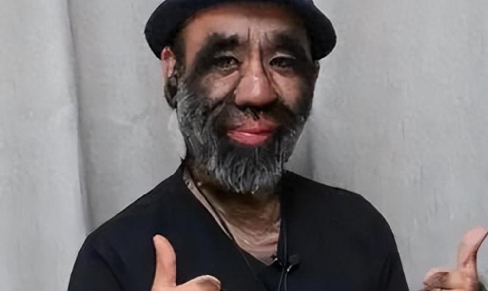 ​毛孩于震寰：一出生全身是毛，8岁演电影爆红，如今开公司娶娇妻