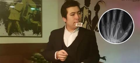 美国魔术师手掌植入芯片 但他忘记了密码(图1)