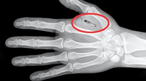美国魔术师手掌植入芯片 但他忘记了密码(图2)
