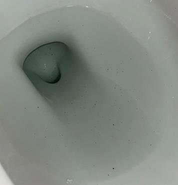 马桶出现很多小黑点怎么回事?如何彻底清除马桶黑斑