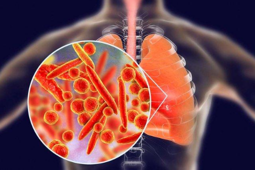 支原体肺炎会复发吗?二次感染怎么办