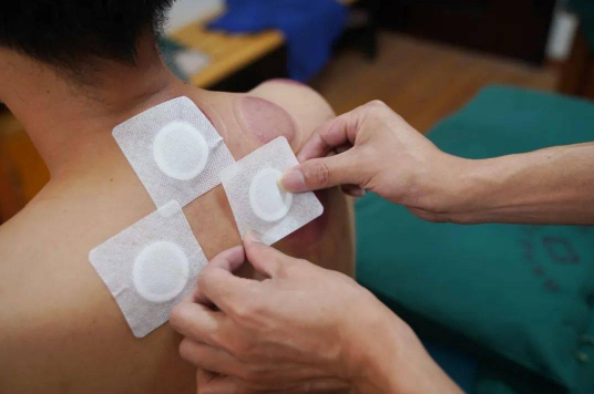 三伏贴末伏不贴有影响吗?末伏不贴效果打折吗