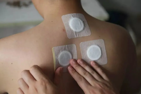 三伏贴末伏可以晚几天贴吗?错过末伏还能贴吗