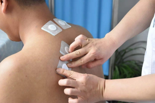 三伏贴是一伏贴一次吗?贴几次效果最好