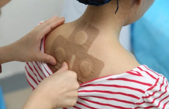 三伏贴是一伏贴一次吗?贴几次效果最好