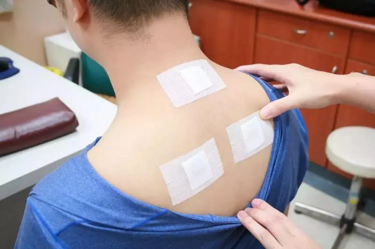 三伏贴是一人一方吗？如何正确使用