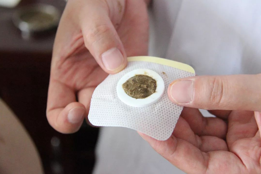 三伏贴中伏贴几次好？20天一次还是两次效果佳