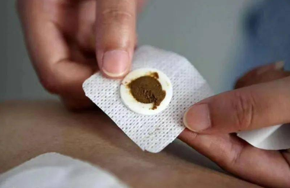 三伏贴中伏贴几次好?20天一次还是两次效果佳