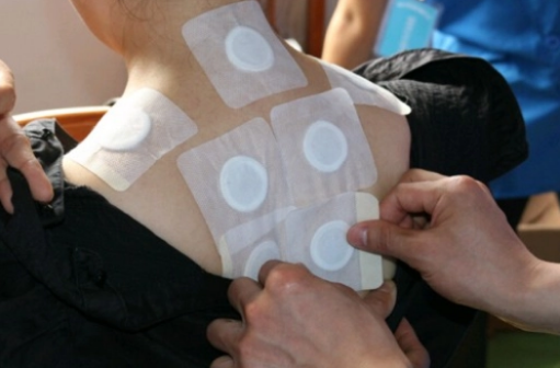 三伏贴两贴间隔长好还是短好?最佳间隔时间是多久