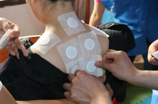 三伏贴只贴一伏有效吗?效果能持续多久