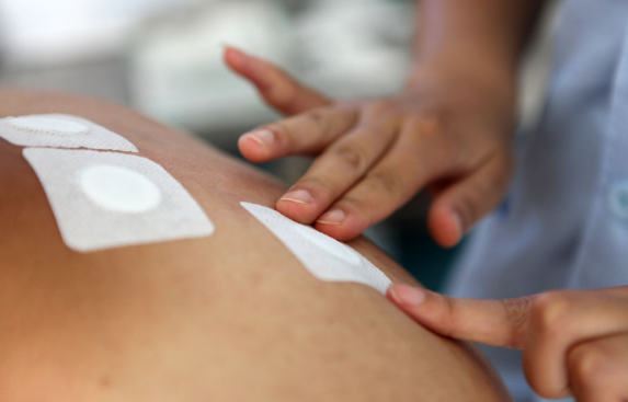 贴三伏贴针扎疼正常吗?如何缓解疼痛