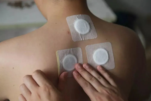 贴三伏贴针扎疼怎么回事?如何缓解疼痛