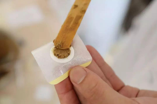 贴三伏贴针扎疼怎么回事?如何缓解疼痛