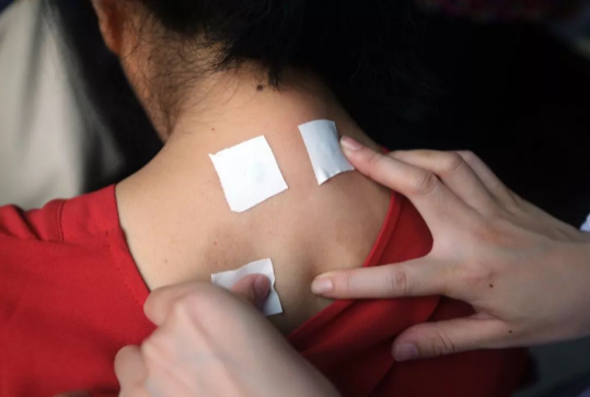 贴三伏贴可以碰冷水吗？三伏贴后多久能洗澡