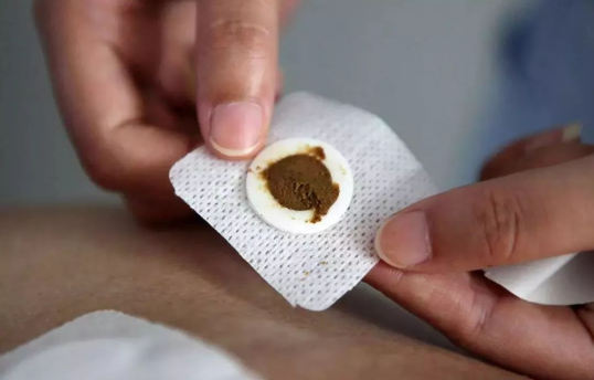 三伏贴初伏没贴中伏还能贴吗?错过初伏怎么办