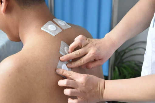 三伏贴价格不等效果一样吗?高价效果更好吗