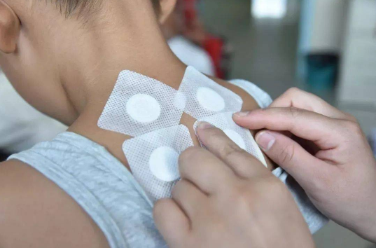 三伏贴为何发热或发凉?贴后反应差异大吗