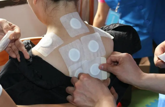 三伏贴漏贴影响效果吗？中途少一贴有效吗