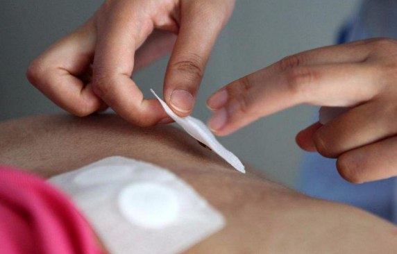 贴三伏贴没反应正常吗?三伏贴没效果怎么办