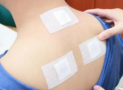 三伏贴可以下午去贴吗?下午贴效果好吗