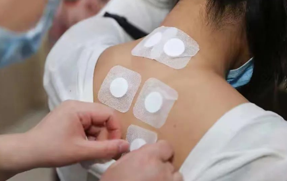 三伏贴能刷医保卡吗?报销条件是什么